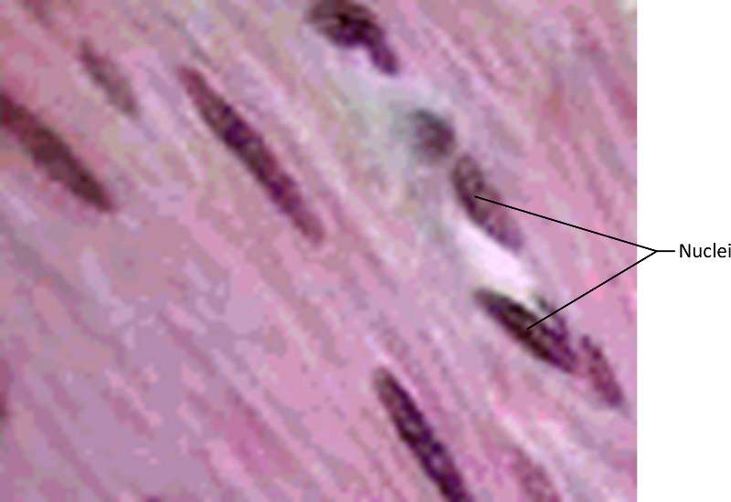 Smooth Muscle micrograph